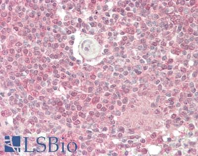 IHC-plus™ Polyclonal Rabbit anti-Human MYO5C Antibody (IHC, WB)