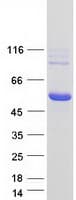 Human ALDH3A2 Protein (Recombinant Myc-DDK (Flag))