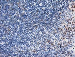 LIMK1 / LIMK Antibody (clone OTI2A11)