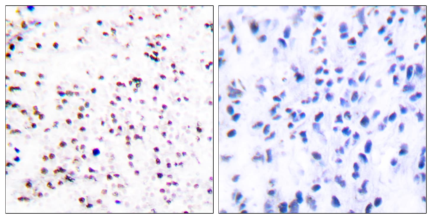 MCM5 Antibody (aa21-70)