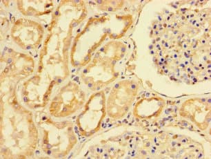 Polyclonal Rabbit anti-Human MRPS10 Antibody