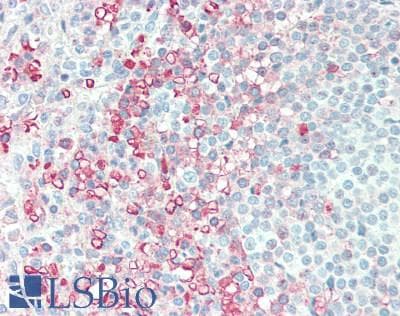 IHC-plus™ Polyclonal Rabbit anti-Human AMICA / JAML Antibody (aa43-72, IHC, WB)