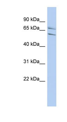 PHF21A / BHC80 Antibody (N-Terminus)