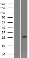 SLC22A18AS Protein (Over-Expression Lysate Myc-DDK (Flag))