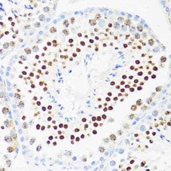 Polyclonal Rabbit anti-Human DDX21 Antibody (IHC, IF)