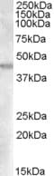 IHC-plus™ Polyclonal Goat anti-Human GOT2 Antibody (aa295-306, IHC, WB)