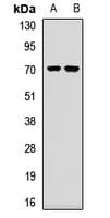 Polyclonal Rabbit anti-Human PABPC4 Antibody (IHC, WB)