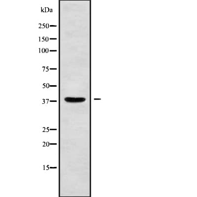 MAGEB10 Antibody