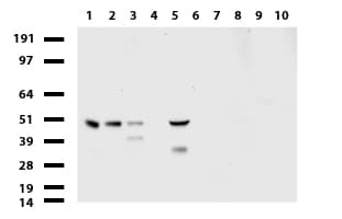 Monoclonal Mouse anti-Human PDSS2 / DLP1 Antibody (clone UMAB177, IHC, WB)