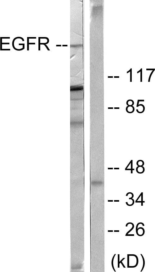 EGFR Antibody (p678)