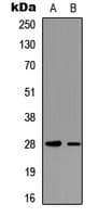 Polyclonal Rabbit anti-Human TNNI3 / Cardiac Troponin I Antibody (phospho-Thr142, WB)