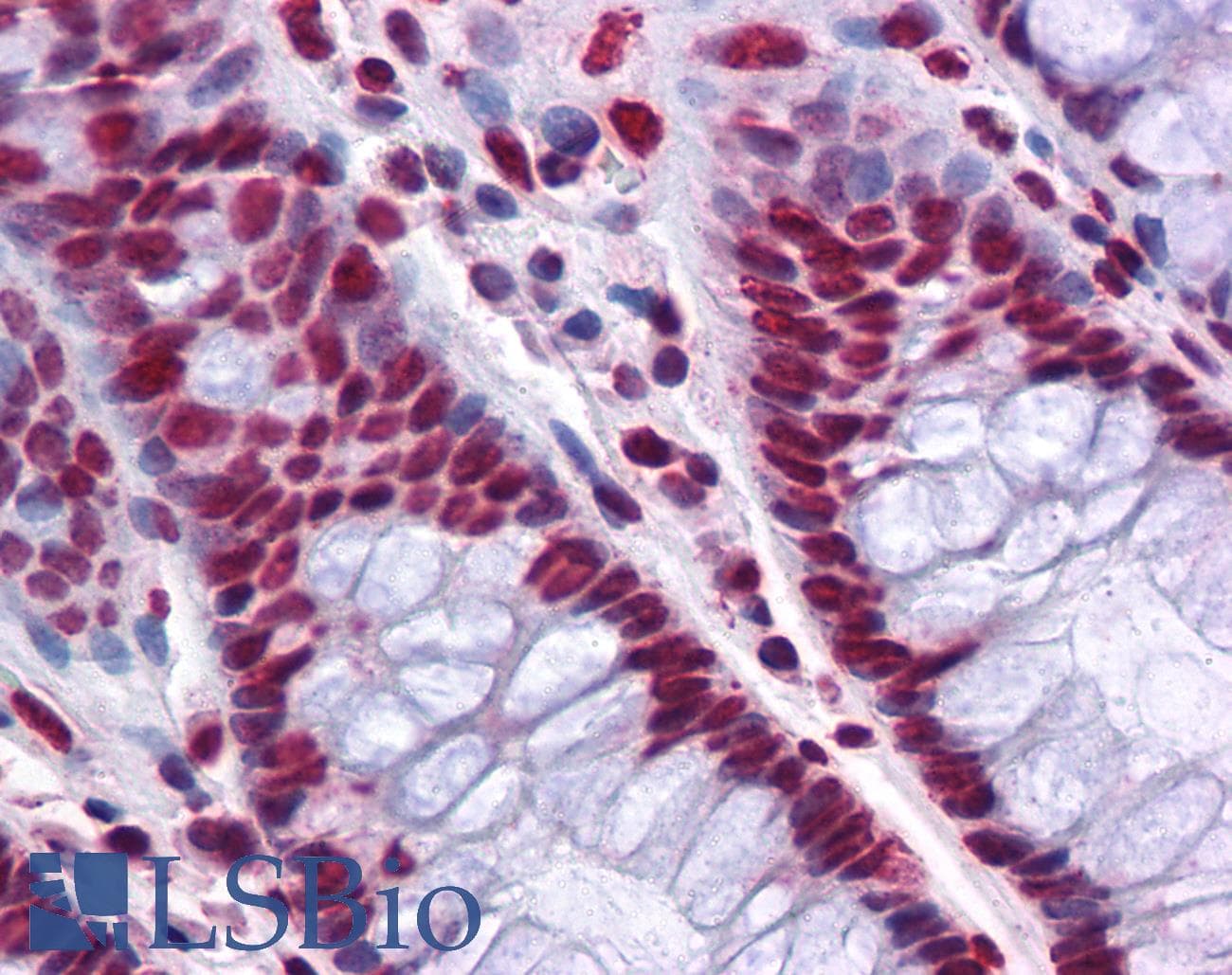 IHC-plus™ THOC6 Antibody (clone 1F6)
