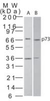 IHC-plus™ Polyclonal Rabbit anti-Human TP73 / p73 Antibody (aa75-125, IHC, WB)