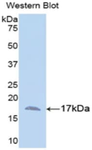 ANXA3 / Annexin A3 Antibody (aa26-160, APC)