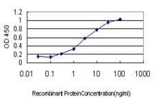 IHC-plus™ IFI16 Antibody (clone 2E3)