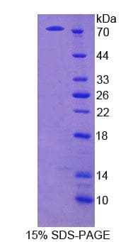 Mouse ECM1 Protein (Recombinant His-GST)