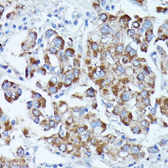 PDE3A Antibody