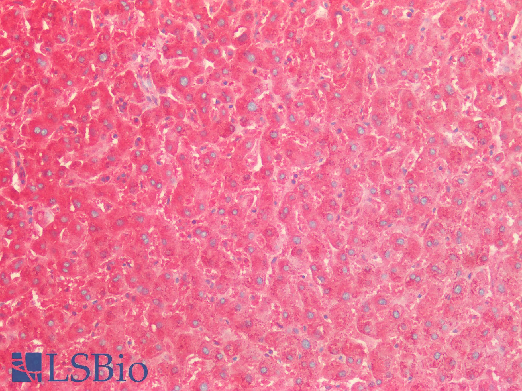 PathPlus™ SOD2 / Mn SOD Antibody (aa119-130)