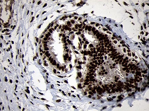 SMC1A / SMC1 Antibody (aa889-1016, clone OTI11E1)