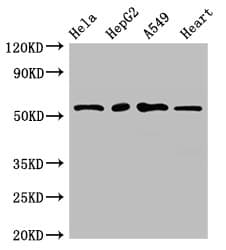 Polyclonal Rabbit anti-Human MEF2D Antibody (IHC, WB)