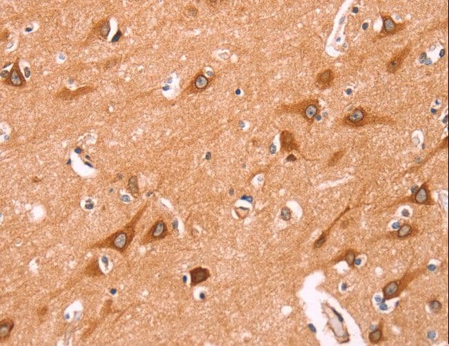NCEH1 / AADACL1 Antibody