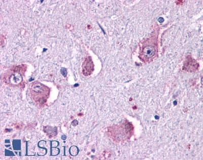 PathPlus™ Polyclonal Rabbit anti-Human HRH1 / Histamine H1 Receptor Antibody (Extracellular Domain, IHC)