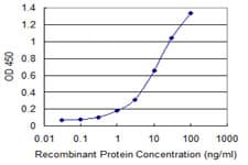 IHC-plus™ STX18 / Syntaxin 18 Antibody (clone 2E5)