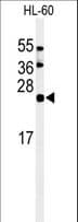 ISG15 Antibody (aa136-165)