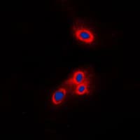 Polyclonal Rabbit anti-Human VAV2 Antibody (N-Terminus, IF, WB)