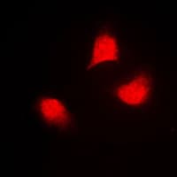 Polyclonal Rabbit anti-Human MAP2K4 / MKK4 Antibody (phospho-Thr261, IHC, IF, WB)