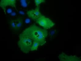 C21orf59 Antibody (clone OTI1F1)