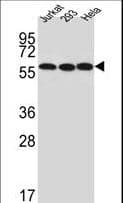 Polyclonal Rabbit anti-Human UTP6 Antibody (aa16-43, WB)