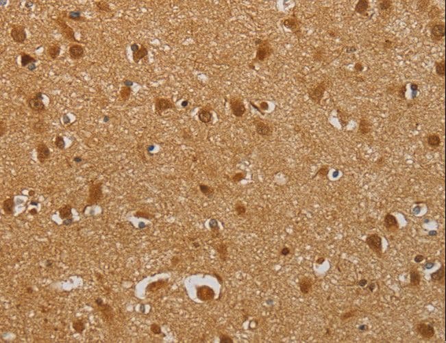 AHSG / Fetuin A Antibody