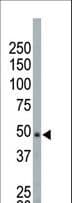 NEK2 Antibody (aa350-382)