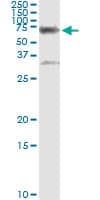 IHC-plus™ CBS Antibody (clone 3E1)