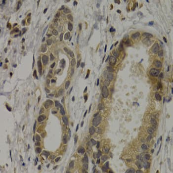 MAGEA1 / MAGE 1 Antibody