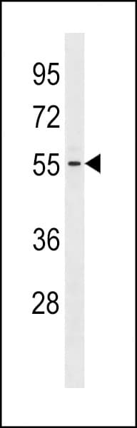 Polyclonal Rabbit anti-Human GTDC1 Antibody (aa278-304, WB)