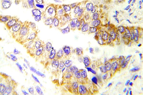 Polyclonal Rabbit anti-Human Tuberin / TSC2 Antibody (aa1211-1260, IHC)