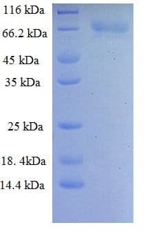 Hepatitis C Virus HCV Genome Polyprotein (Recombinant His)