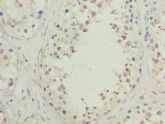 Polyclonal Rabbit anti-Human SPACA1 Antibody (IHC)
