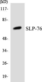 LCP2 / SLP-76 Antibody (aa73-122)