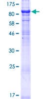 Human MON1A / SAND1 Protein (Recombinant GST)