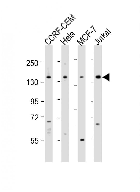 PLCG1 Antibody (aa456-488)