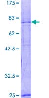 Human KIF2A Protein (Recombinant GST)
