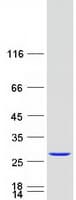 Human Recoverin Protein (Recombinant Myc-DDK (Flag))