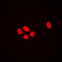 EXO1 Antibody (N-Terminus)