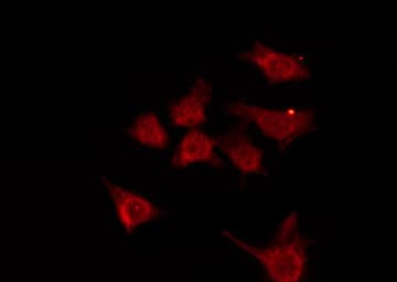 Polyclonal Rabbit anti-Human OR7A10 Antibody (IF, WB)