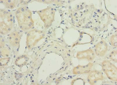 PORCN Antibody