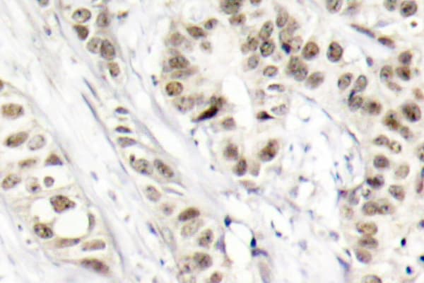Polyclonal Rabbit anti-Human BRCA1 Antibody (phospho-Ser1524, IHC)