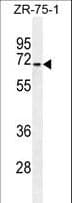 Polyclonal Rabbit anti-Human HAUS3 / C4orf15 Antibody (aa372-400, IHC, WB)